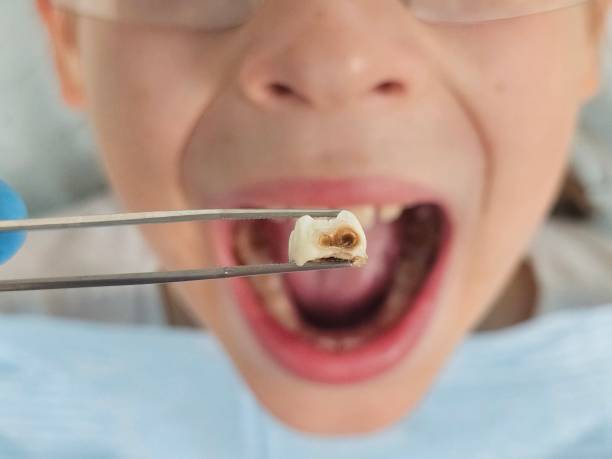 Best Emergency Treatment for Oral Infections in Clemmons, NC
